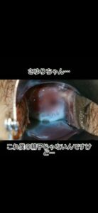 [LAXD-PPV-MSKvygKwa3cFt0MDPE7BeLe](復刻)さゆりちゃんシリーズ番外編　彼氏！？の精子とたったひとつの卵子を奪い合いです。